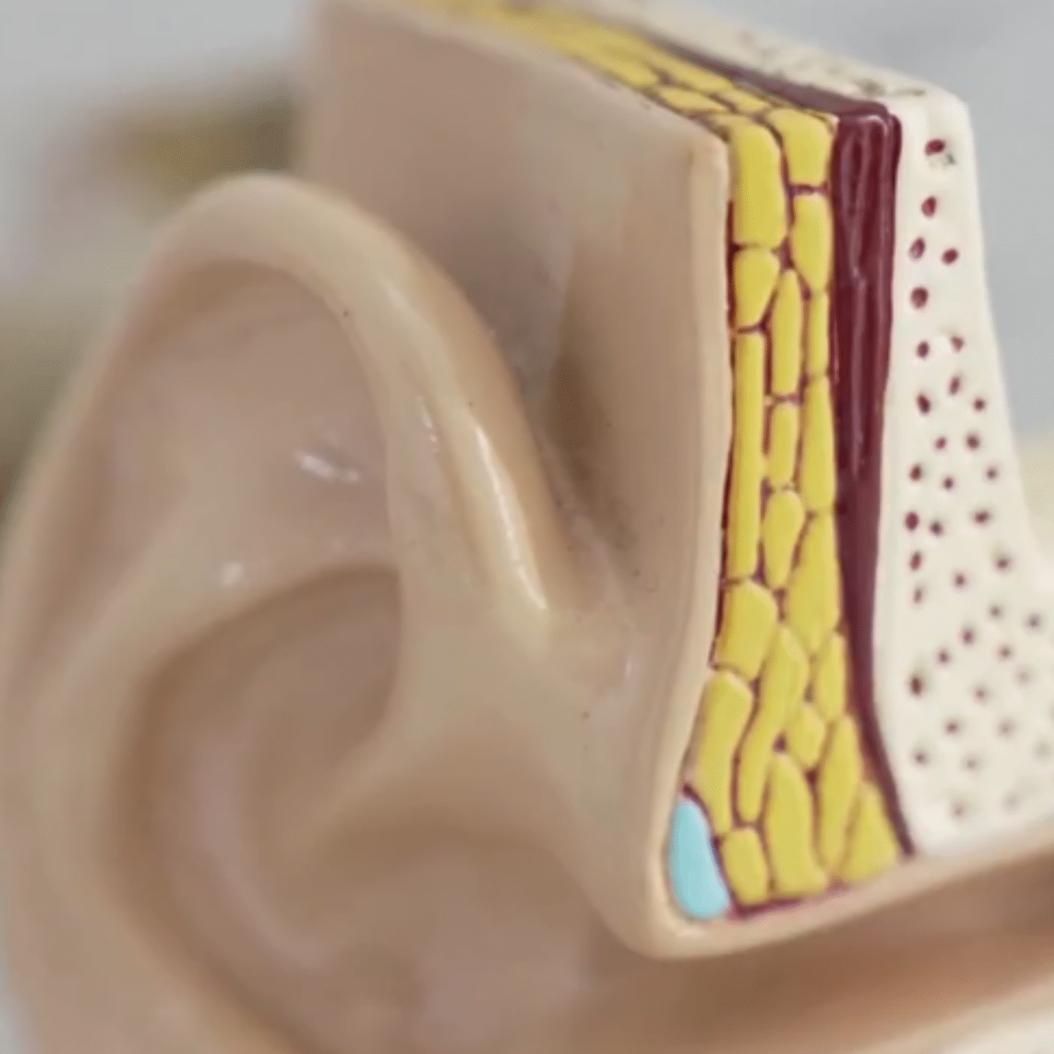 Every service member with hearing impairment can receive a free consultation at the Rhino Clinic.